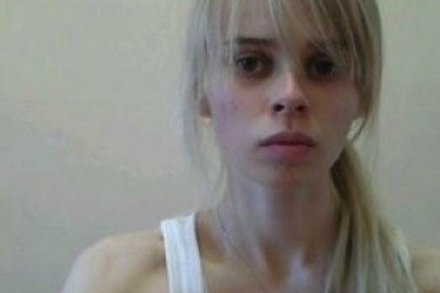 "Non guardo i libri di cucina per non ingrassare": Sophie è anoressica e pesa 25 kg