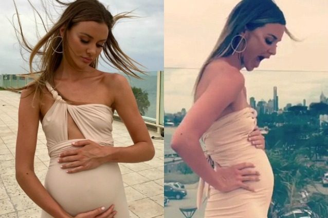 Sembra incinta ma è un effetto della malattia: "Fare la modella non aiuta la mia salute"