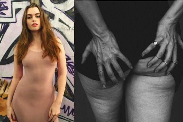 "Non mi vergogno della cellulite": la modella fotografa il lato b e rivela le imperfezioni