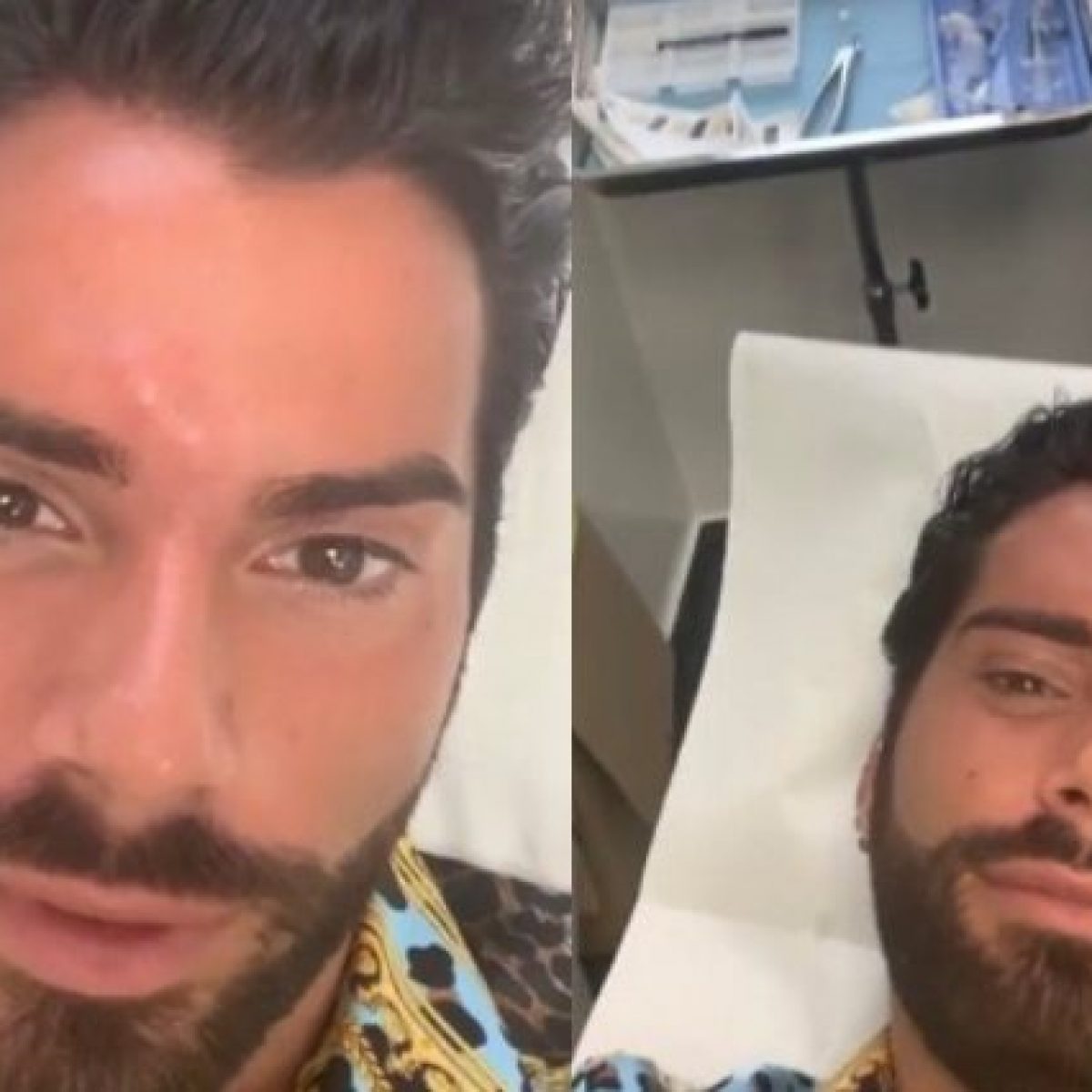 Federico Fashion Style E Il Ritocco Estetico Punture Al Viso Prima Dell Evento Importante