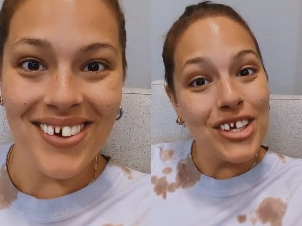 Ashley Graham Il Coraggio Di Mostrarsi Col Dente Rotto E Il Simbolo Della Lotta Agli Stereotipi