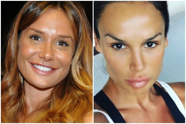 La trasformazione di Nicole Minetti: il volto ? irriconoscibile, si sospetta il ritocchino