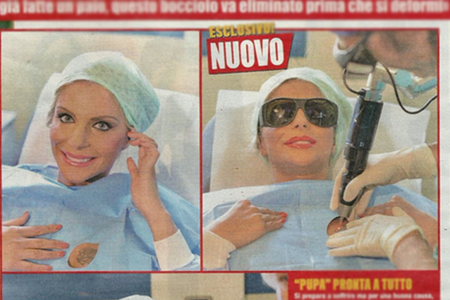 Francesca Cipriani rimuove il tatuaggio perché vuole aumentare la misura del seno