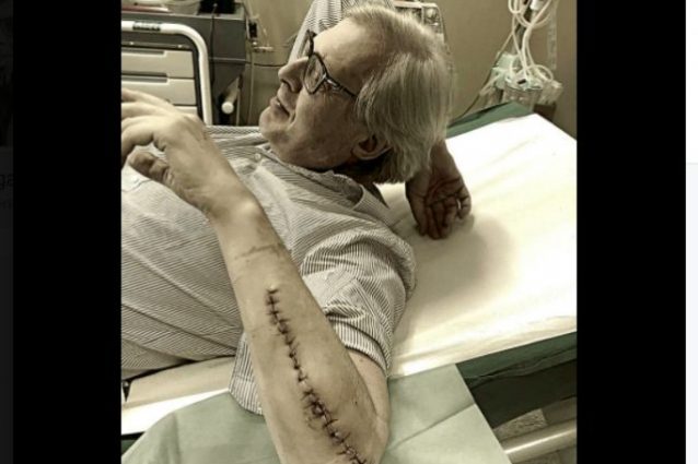 La cicatrice di Vittorio Sgarbi ? vera: ?Reinstallata una protesi al braccio?