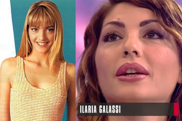 Ilaria Galassi e il ritocco 22 anni dopo 'Non è la Rai': "Ho gonfiato la bocca per l'età"