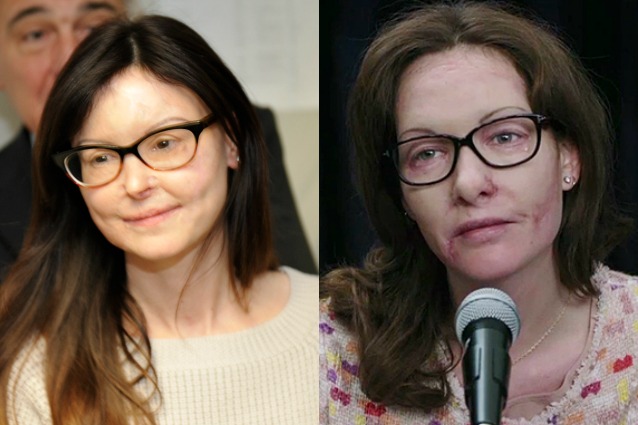 La storia di Lucia Annibali in ‘Io ci sono’, Cristiana Capotondi la protagonista