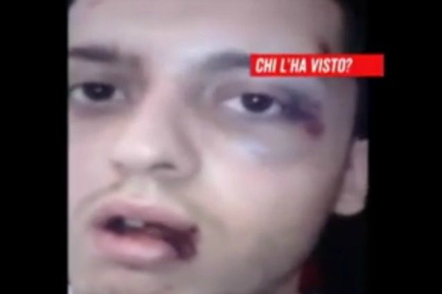 Ragazzo picchiato a sangue senza motivo, il video choc di denuncia a Chi l'ha visto