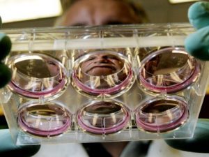 Roma, embrioni per procreazione assistita spariti all'ospedale Pertini: due biologi sotto accusa