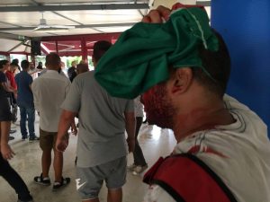 Tiburtino III, scontri tra militanti di Casapound e antifascisti: un ragazzo ferito a cinghiate