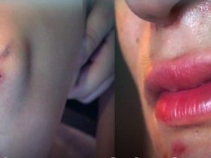 Tiburtino III, Pamela racconta di essere stata sequestrata dai profughi: denunciata per lesioni