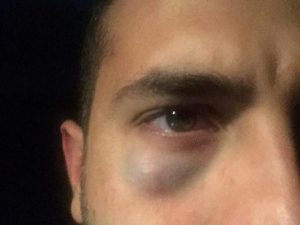 Roma, pugni ai tifosi del Napoli dopo il match con la Lazio: “Napoletani di merda”