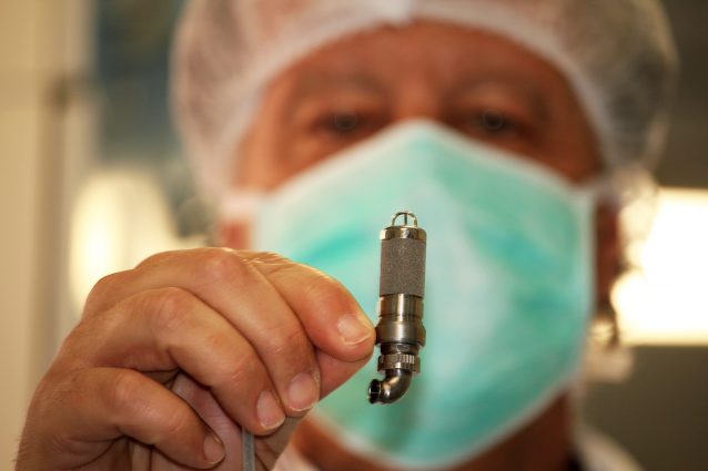 Un mini cuore artificiale salva una bimba di 3 anni Un mini cuore artificiale salva una bimba di 3 anni