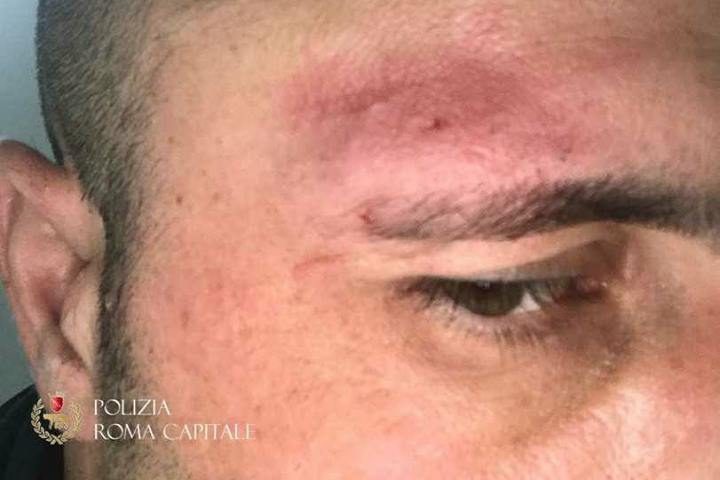 Il vigile urbano ferito durante un controllo a Roma