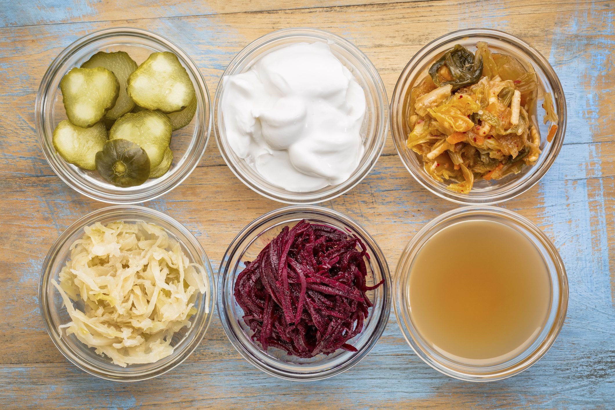 fermented-foods
