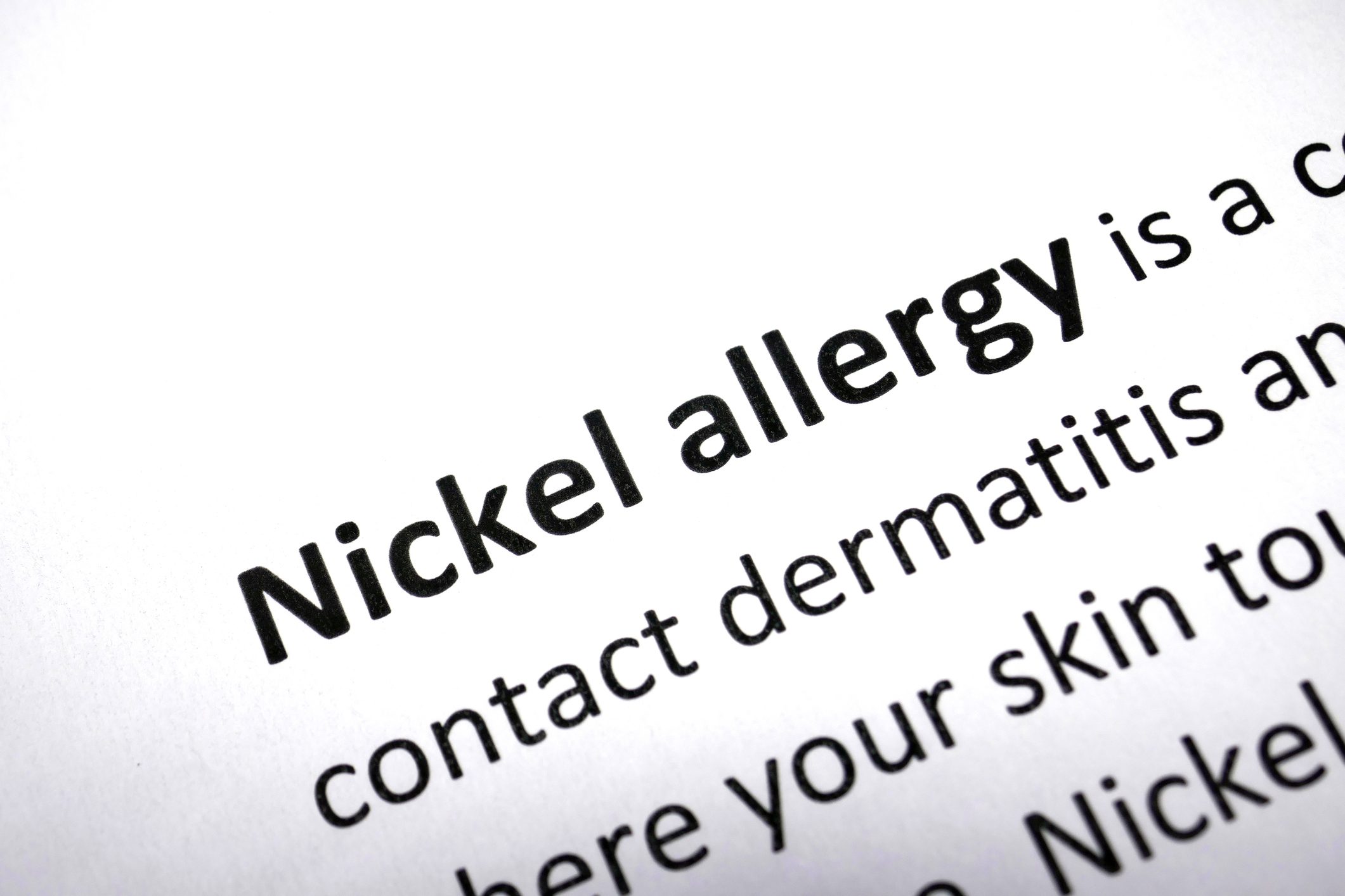 All You Need to Know About the Nickel Allergy