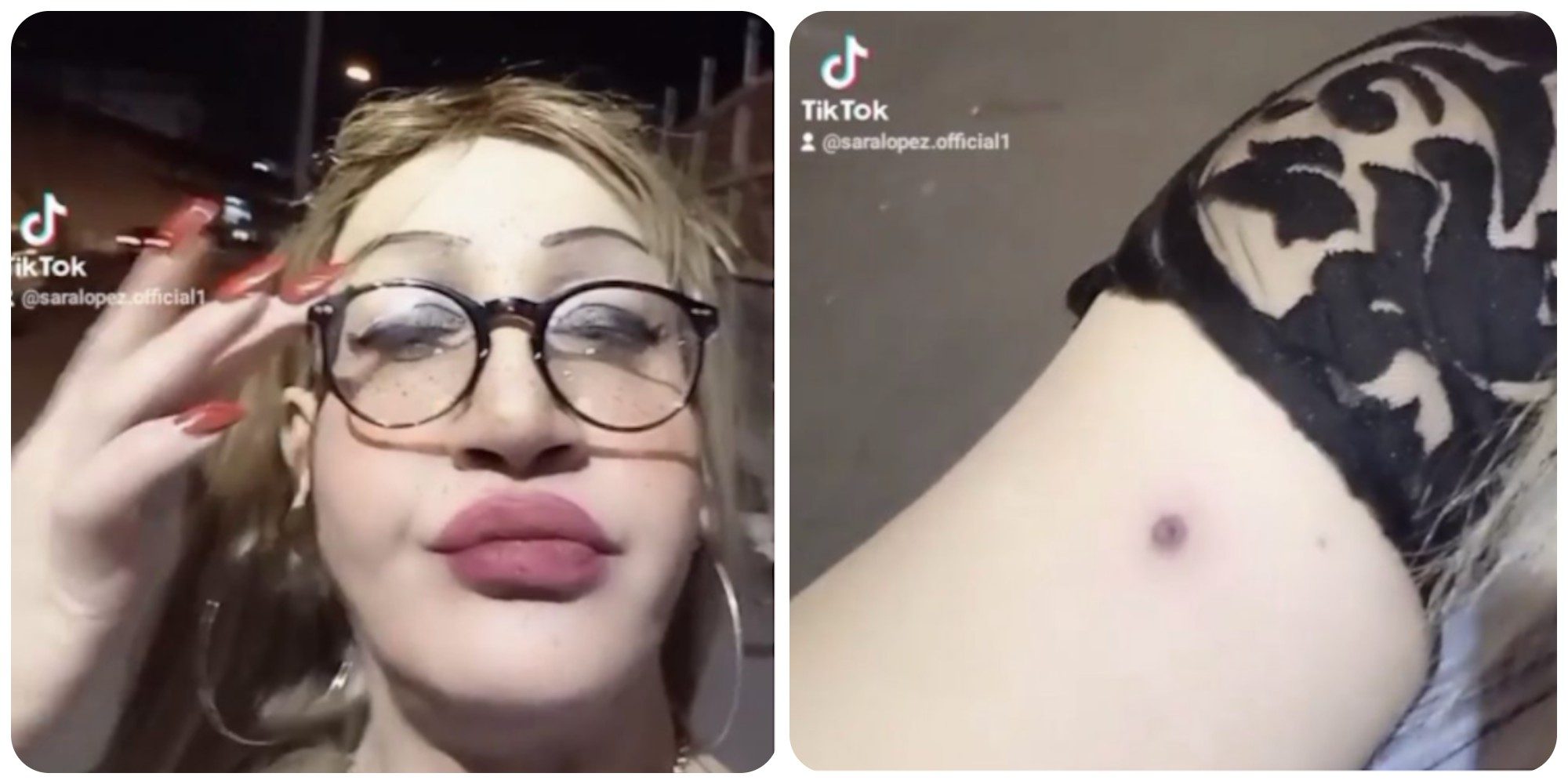 Transgender ferita con pistola a pallini a Pompei, denunciati due giovani - Vimarsana News