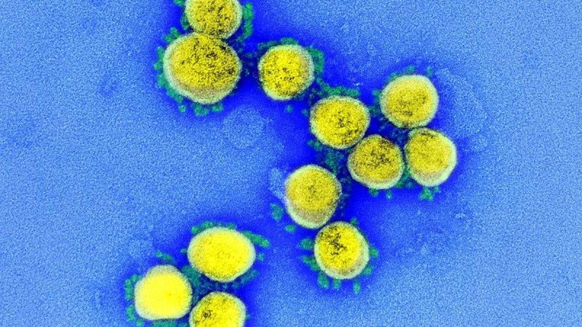 Particelle di Sars-Cov-2 / NIAID