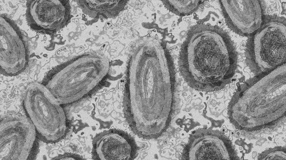 Rappresentazione del monkeypox virus. Credit: geralt / pixabay