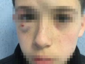 Massacrato di botte a Mugnano, identificati i bulli. Ma non andranno in galera: sono piccoli