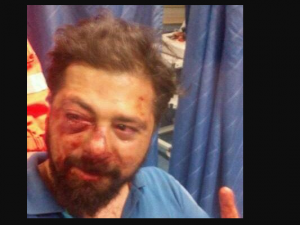 Pestato a sangue per un cellulare in via Brin da 3 rapinatori