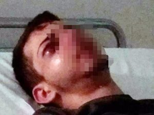 Il ragazzo pestato dal branco (Facebook)