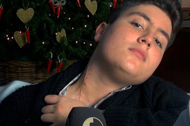 Arturo, il 17enne accoltellato a Via Foria, mostra la cicatrice sul collo.