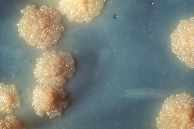 Il batterio Mycobacterium tuberculosis, responsabile della tubercolosi nell'uomo e resistente a molti antibiotici.