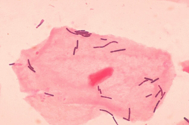 Il Lactobacillus