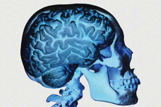 Curare l'Alzheimer proteggendo l'arginina