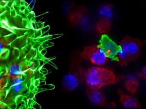 Ecco come dei super linfociti T uccidono le cellule tumorali