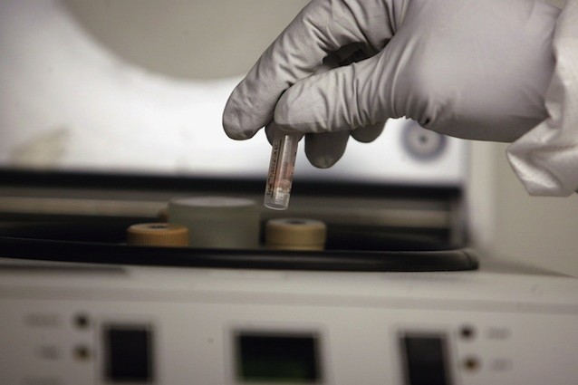 Stop Vivisection chiede l'abolizione della sperimentazione animale
