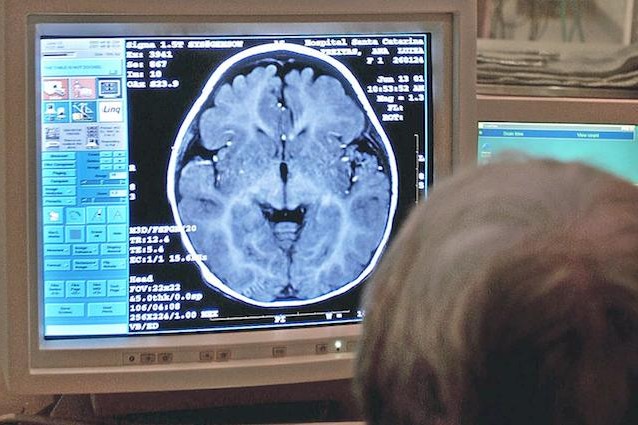 Il cervello e la gestione del dove e del quando