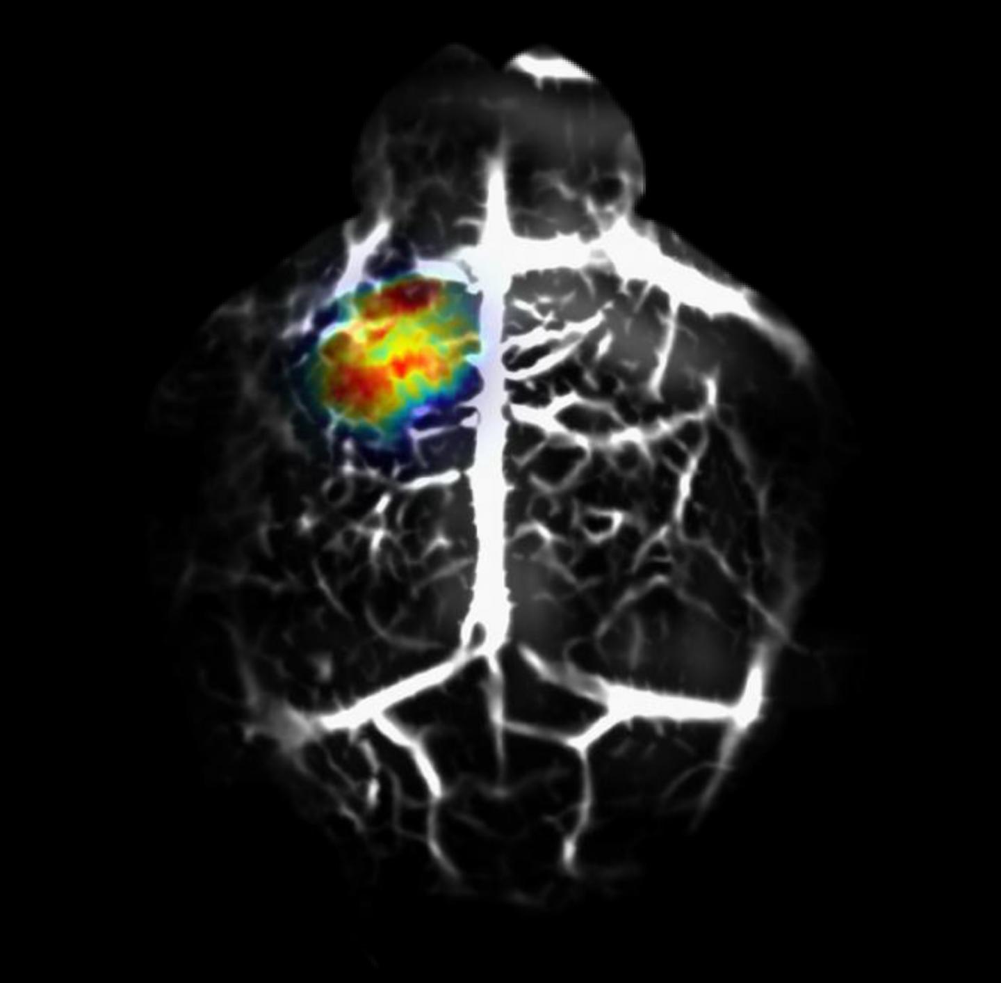 Cervello murino con cellule tumorali in evidenza grazie alla tecnica dei ricercatori (Junjie Yao and Lihong Wang)