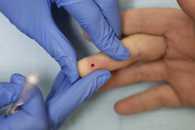 Diabete di tipo 1: e se non ci fosse più bisogno dell'insulina?