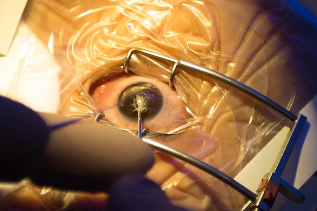 È possibile tornare a vedere grazie al trapianto di cornea di maiale?