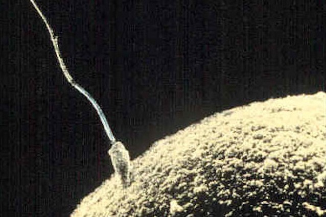 Il contraccettivo 'appiccicoso' attira lo sperma per evitare le gravidanze