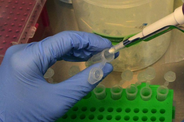 Studio italiano: terapia genica efficace contro la malattia di Krabbe