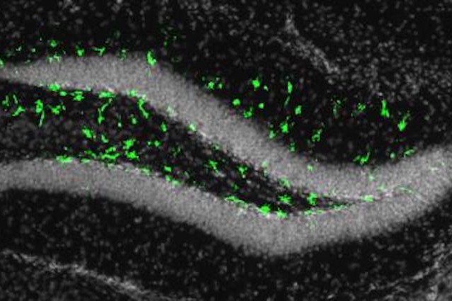 Il virus Zika potrebbe danneggiare anche il cervello degli adulti