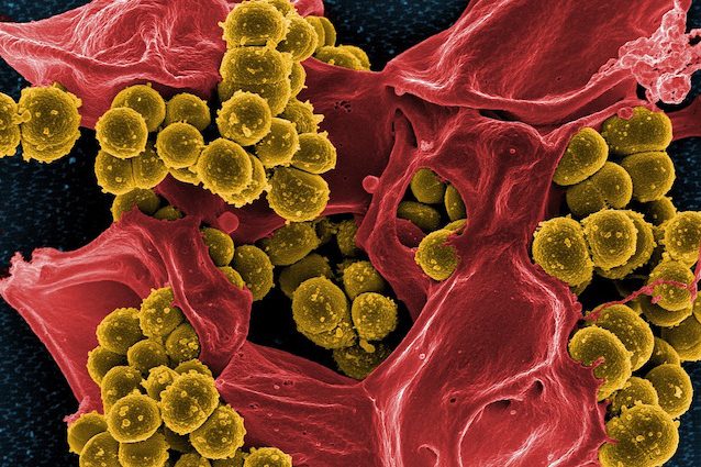 Sepsi, cos'è la malattia killer che uccide una persona ogni 3 secondi