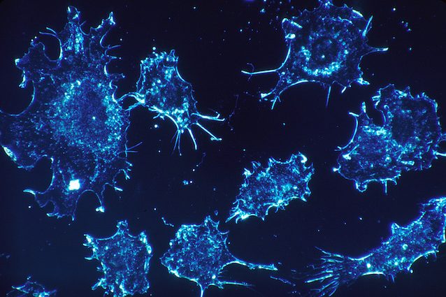 Riduce del 40% il rischio di morte: cos'è la molecola nemica del cancro ai polmoni
