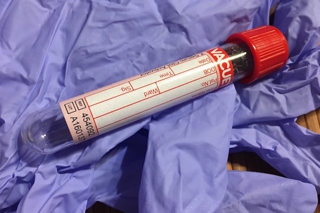 Basta un test del sangue per prevedere il rischio infarti: ecco come funziona