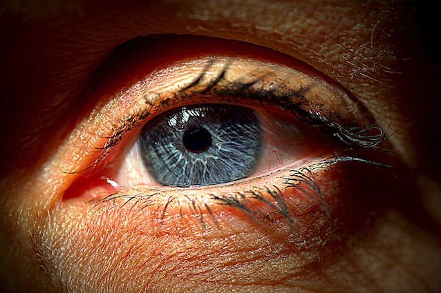 Danneggia gli occhi di 1 milione di italiani, ma solo la metà lo sa: cos’è il glaucoma