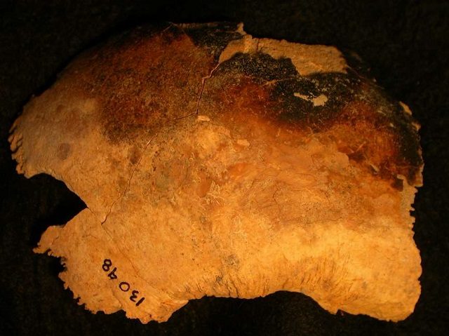 Evidenti segni di bruciatura sulle ossa