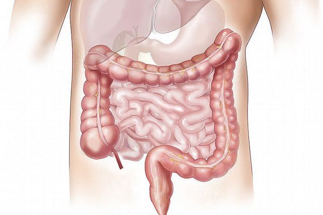 Parkinson: possibile origine nell'intestino. Tagliare il nervo vago riduce il rischio del 40%