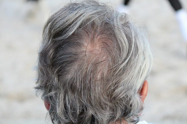 Capelli grigi e calvizie: identificate a sorpresa le cellule responsabili