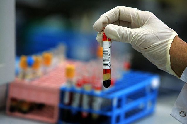 Diabete di tipo 1, anticorpo 'predice' il rischio di ammalarsi: basta un test del sangue