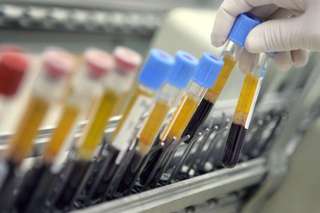 Cancro: come un test del sangue può predire la malattia contando le piastrine