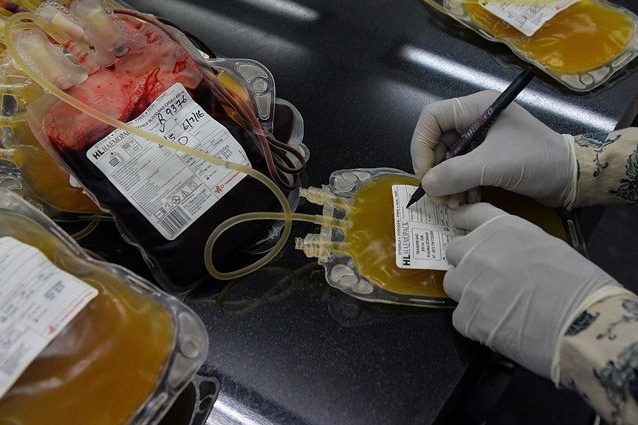 Attacco di cuore: sei più a rischio se non hai 0 come gruppo sanguigno, ecco perché