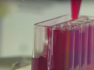 Test Iset: si possono prevenire i tumori con una analisi del sangue?