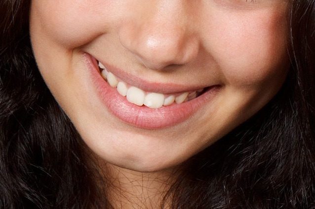 Vuoi un sorriso perfetto? Il segreto: “Meno è, meglio è”. Ecco perché